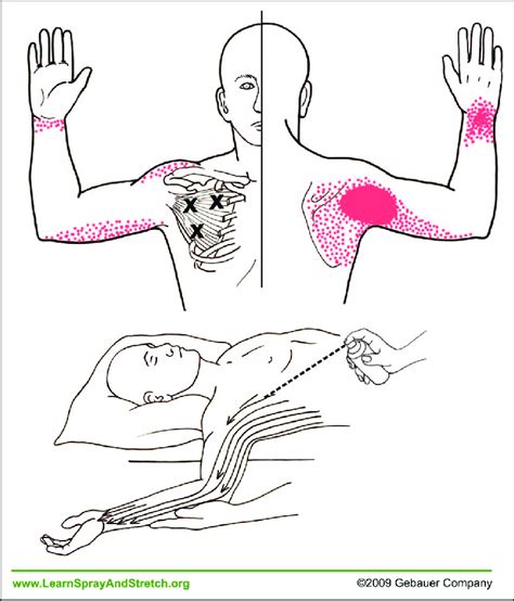 Supraspinatus Stretch