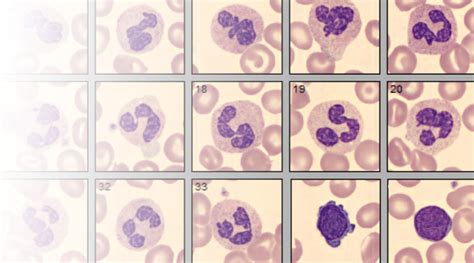 Pemeriksaan Hematologi Rutin | Pre Analitik , Analitik dan Post Analitik - patelkijabar.org