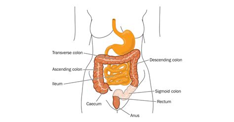 Sigmoidectomy surgery for IBD | IBDrelief