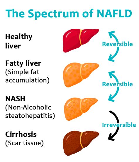 Fibroscan Images Of Fatty Liver