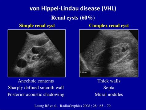 MEDICAL ULTRASOUND/RENAL CYST