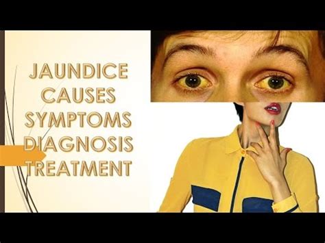 Jaundice: Symptoms, Complications, and Treatment