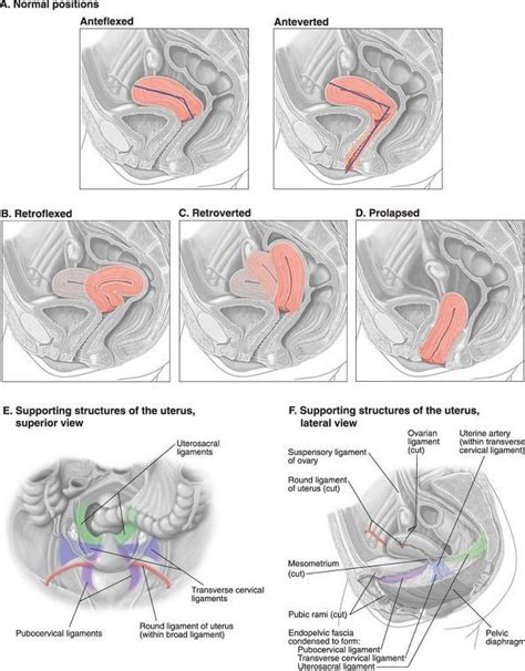 Positions of the uterus | Obstetric ultrasound, Ultrasound sonography, Ultrasound