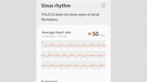 How to take an ECG reading on the Samsung Galaxy smartwatches - Wareable