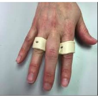 Sagittal Band Rupture Splint