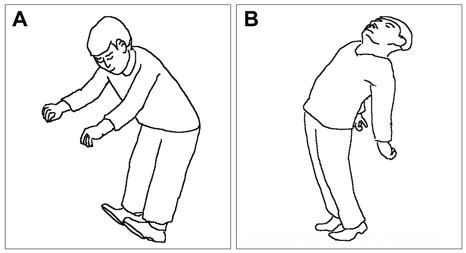 Vestibular Rehabilitation Therapy: Review of Indications, Mechanisms ...