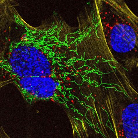 New fluorescent probes to image live cells with super-resolution ...