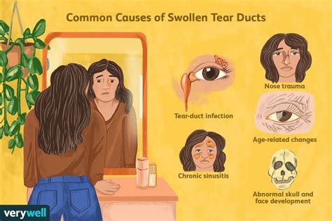 Swollen Tear Duct: Why It Happens and How to Treat It