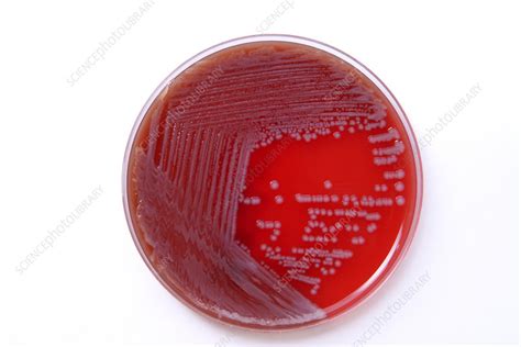 E. coli bacterial culture - Stock Image - M874/0663 - Science Photo Library