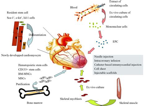 From bench to bedside, work in cell-based myocardial regeneration therapy