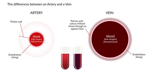 Normal Veins vs Varicose Veins Differences | Southwest Veins