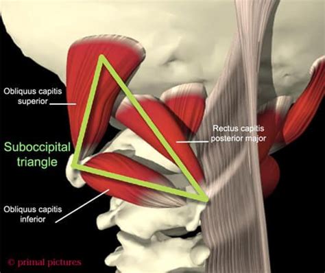 Suboccipital Triangle & Headaches | Physical therapy, Body diagram, Doctor of chiropractic