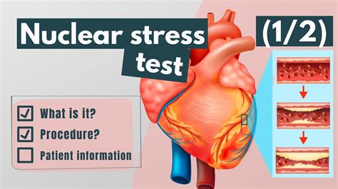 Nuclear stress test: Purpose, procedure & patient information (1/2) - YouTube