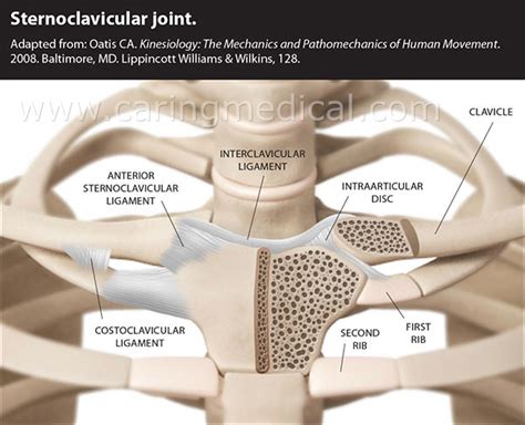 Sternoclavicular post-traumatic joint injury and instability treatment