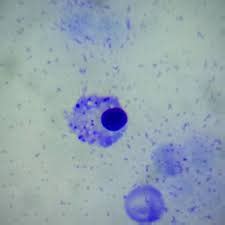 What are Amoeboid Cells? | Study.com