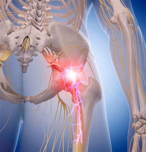 Nerve and Chronic Pain - Bothwell Medical Rooms Pain Medicine Clinic - Fast access to treatment