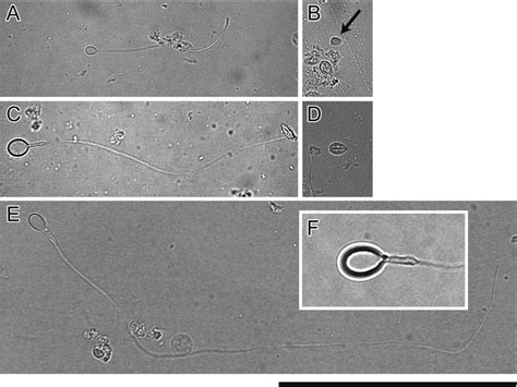 Two types of nematocysts of Aurelia coerulea from Tanabe Bay, Japan ...