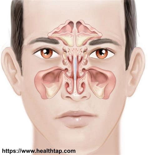 Paranasal Sinuses Infection Des Sinus, Upper Respiratory Infection ...