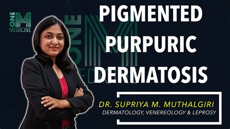 Chapter 31 | Pigmented Purpuric Dermatosis | Dermatology | OneMedicine - YouTube