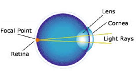 About Your Vision - LASIK - Flaum Eye Institute - University of Rochester Medical Center