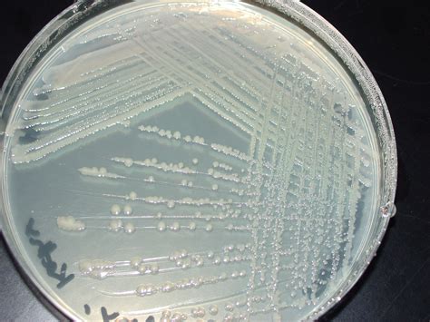 plate of Enterobacter aerogenes that's been streaked for isolation ...