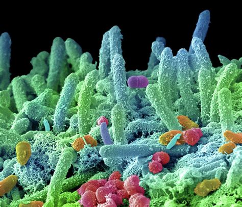 Oral Bacteria Photograph by Steve Gschmeissner