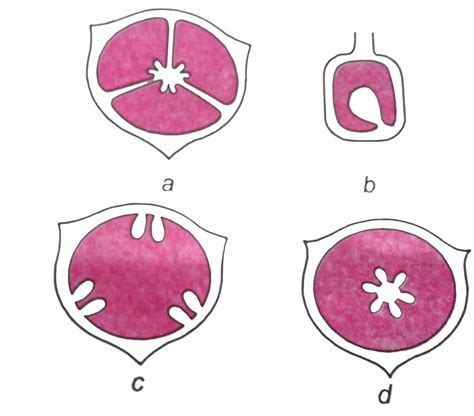 Which one of the following diagrams represents the placentation in Dia