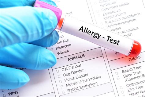 How To Read Allergy Test Results