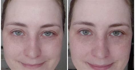 Mothlhtqqjbpqdp: L'Oreal Revitalift Before And After