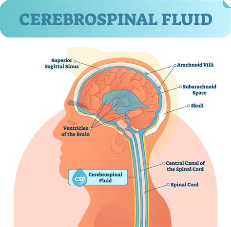 Cerebrospinal Fluid Leak - Dr. Candice Colby-Scott, MD