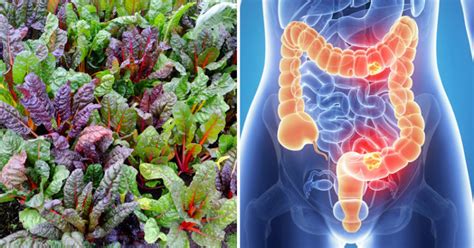 Swiss Chard Health Benefits: 9 Ways This Green Is Great For You