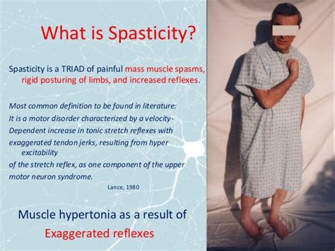 Spasticity in Rehabilitation