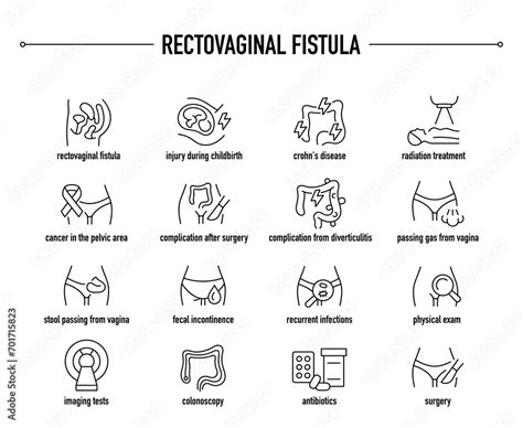 Rectovaginal Fistula symptoms, diagnostic and treatment vector icons. Line editable medical ...