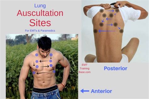 A Guide to Auscultating Lung Sounds - EMT Training Base | Lung sounds, Auscultating lung sounds, Emt