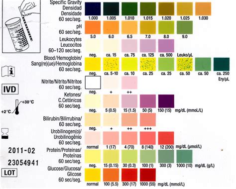 Urine - Specific Gravity | Lab Tests Guide