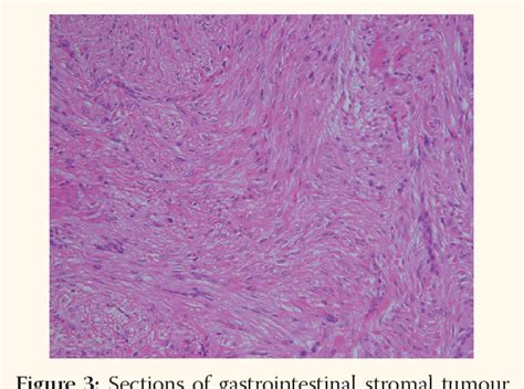 Interstitial Cells Histology