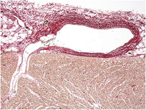 Interventricular Septum Histology