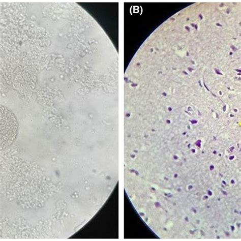 Toxoplasma cysts in brains of mice after infection with the... | Download Scientific Diagram