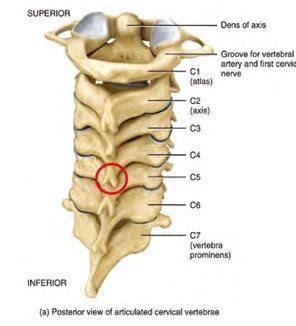 Exercise programme following cervical spine decompression surgery | CUH