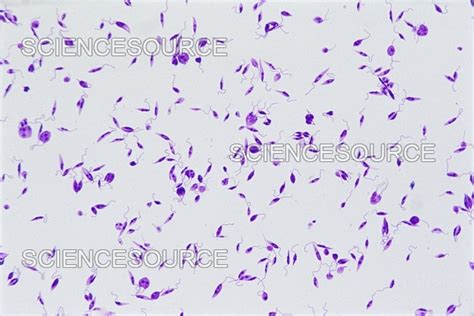 Leishmania donovani, LM | Stock Image - Science Source Images