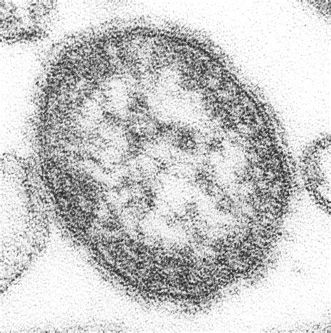 Measles Virus | Concise Medical Knowledge