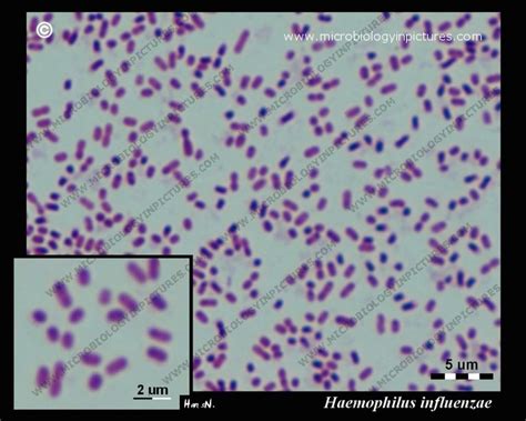 Haemophilus Influenzae Gram Stain | www.pixshark.com - Images Galleries ...