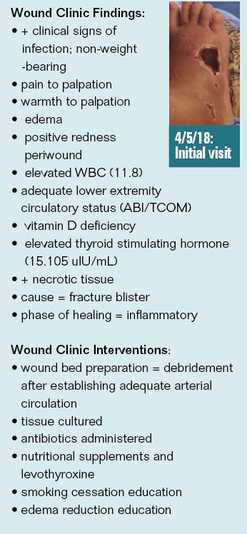 Wound Clinic Case Study: Fracture Blister