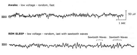 The Five Stages of Sleep: Characteristics of non-REM & REM