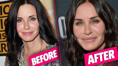 Frozen Face! Courteney Cox Had EXTREME Plastic Surgery On 'Lips, Eyes ...