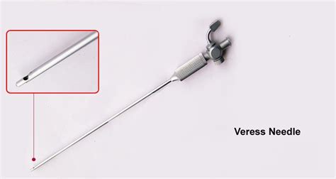 Laparoscopic Closed Access Technique