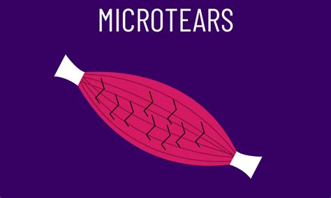 Do Microtears in the Muscle Cause Growth? Science Analysis - House of Hypertrophy