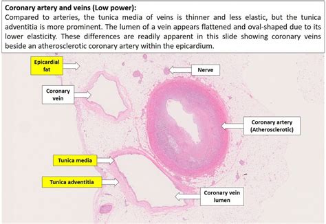 Vessels Histology Blood Vessels Histology Slide