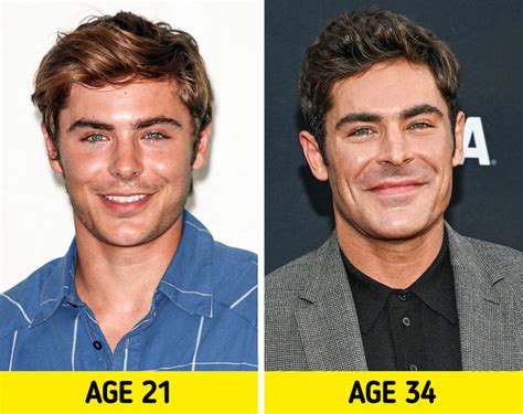 “I Almost Died,” Zac Efron Reveals the Truth Behind Plastic Surgery Rumors / Bright Side