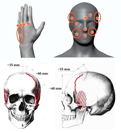 Dyatlov Pass Incident Autopsy